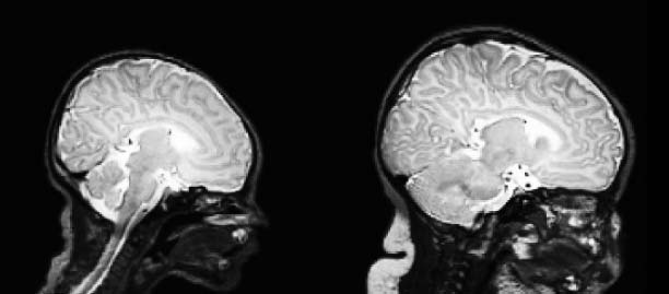 МРТ головного мозга ребенка и взрослого